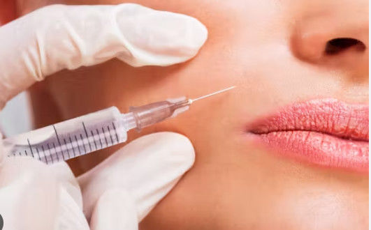 よい価格 コスメティック用注射用のマイクロニードル オンライン