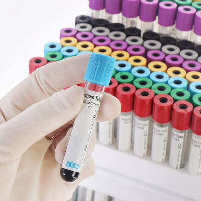 よい価格 Vacuum EDTA Blood Tubes for Complete Blood Count (CBC) – High Quality, Secure Seal オンライン